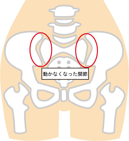 下半身骨格