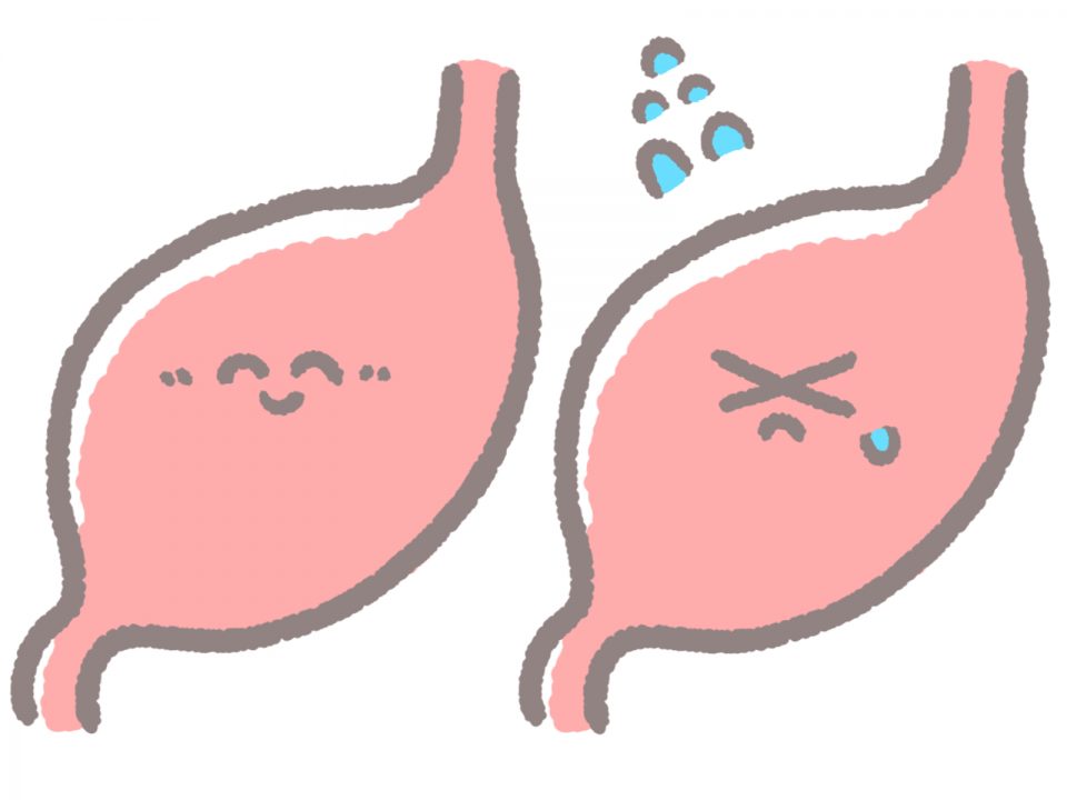 元気な胃と疲れた胃のイラスト