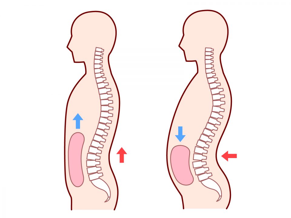 内臓下垂のイラスト