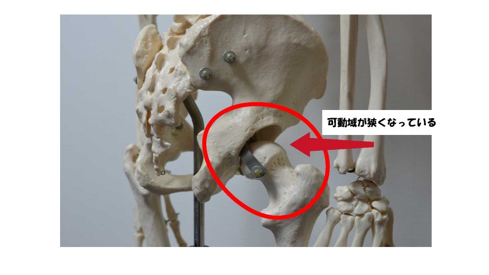 股関節の写真