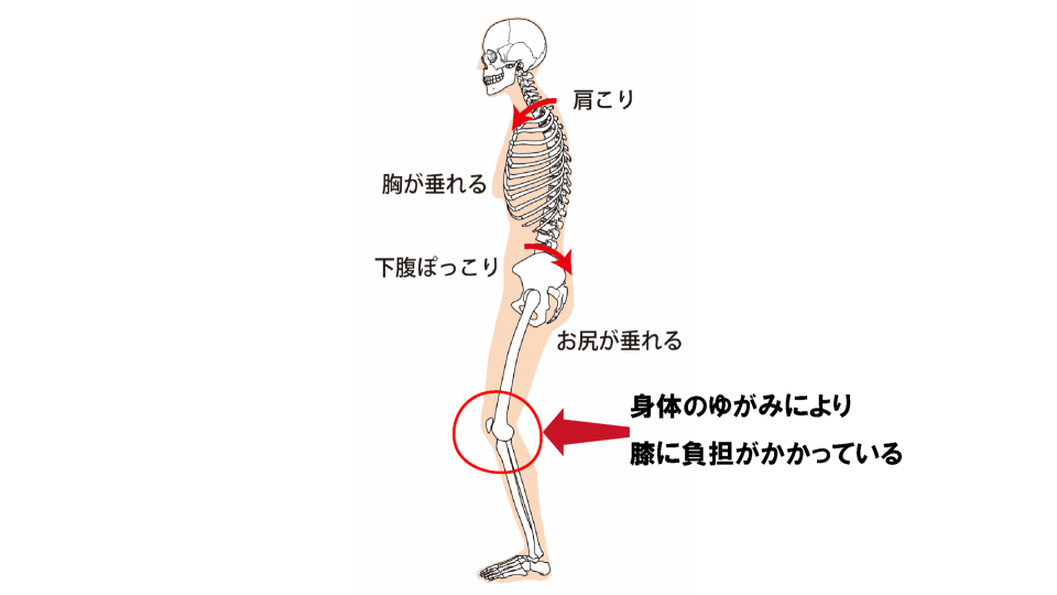 骨格のゆがみ